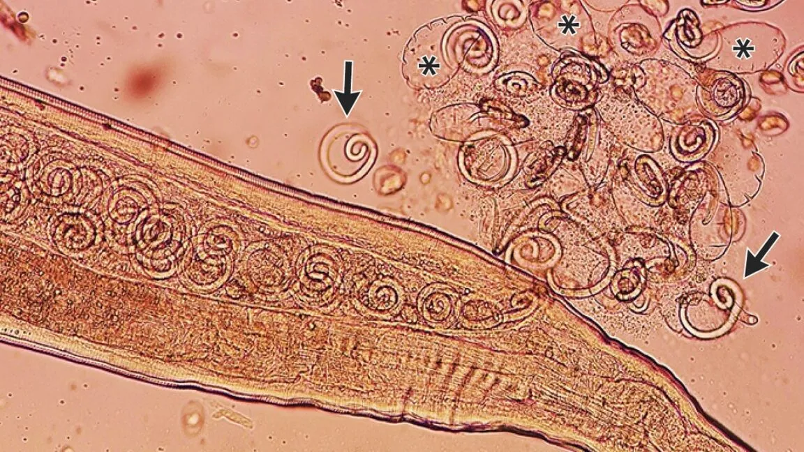 Thelazia callipaeda infection: Understanding the eye worm case study